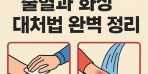 응급처치 뜻 - 화상-출혈-처치방법-완벽정리-썸네일